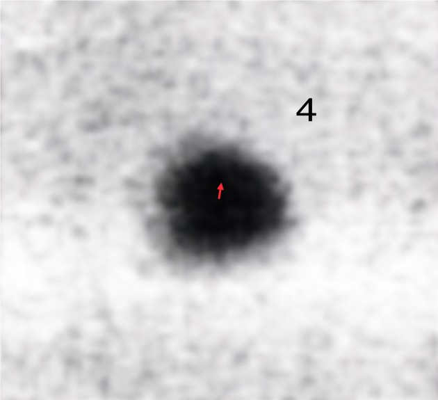 1919 Solar Eclipse, Star4shift